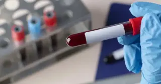 Edital Hemominas oferece 347 vagas com salários de até R$6 mil!